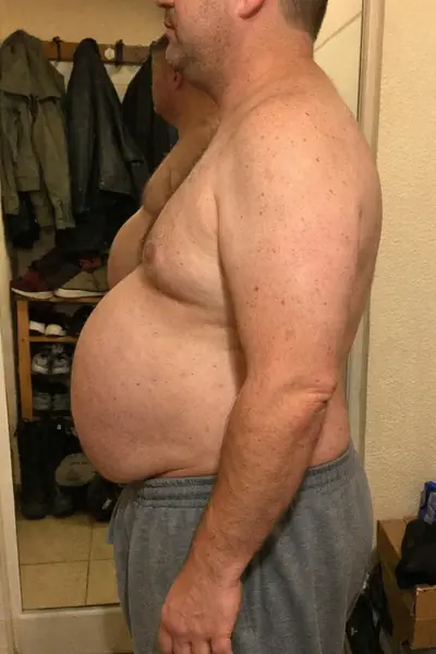 Vorher
